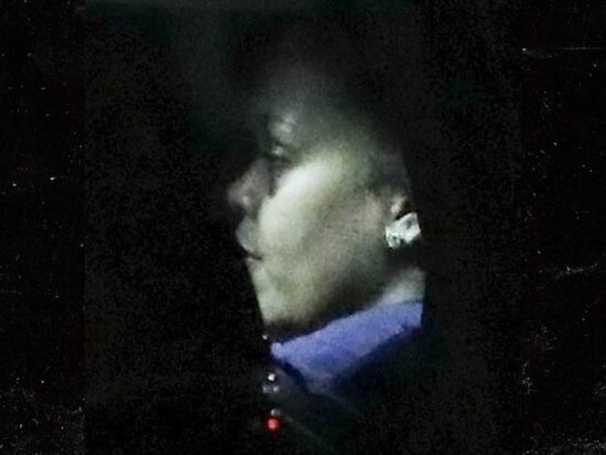 Rihanna spotted with bruised face (Source; TMZ)